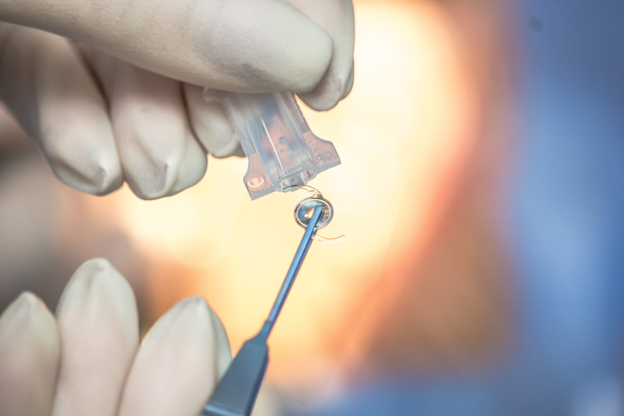 What Is a Light Adjustable Lens? Nutfield Eye Associates